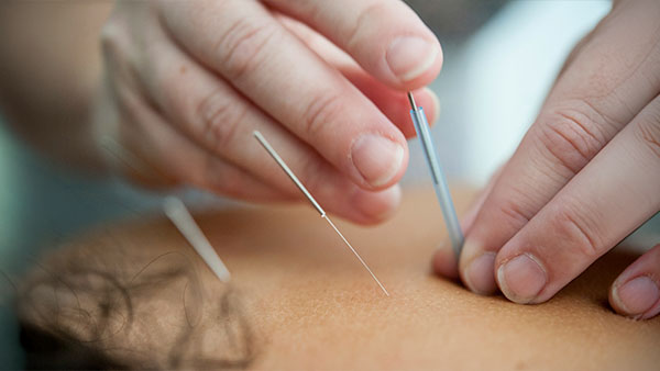 Rehab 4 Humans Acupuncture