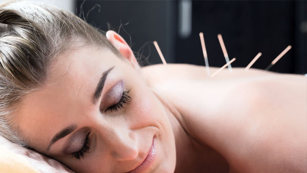 Rehab 4 Humans Dry Needling